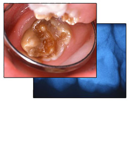 Orale Pathohistologie