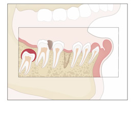 Pathologie des Kieferknochens